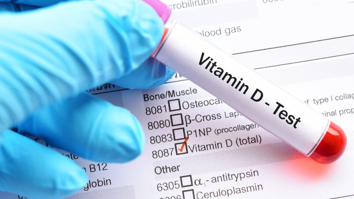 Nhóm nghiên cứu cảnh báo người dân không nên lạm dụng việc uống vitamin D. Ảnh minh họa: Nytimes